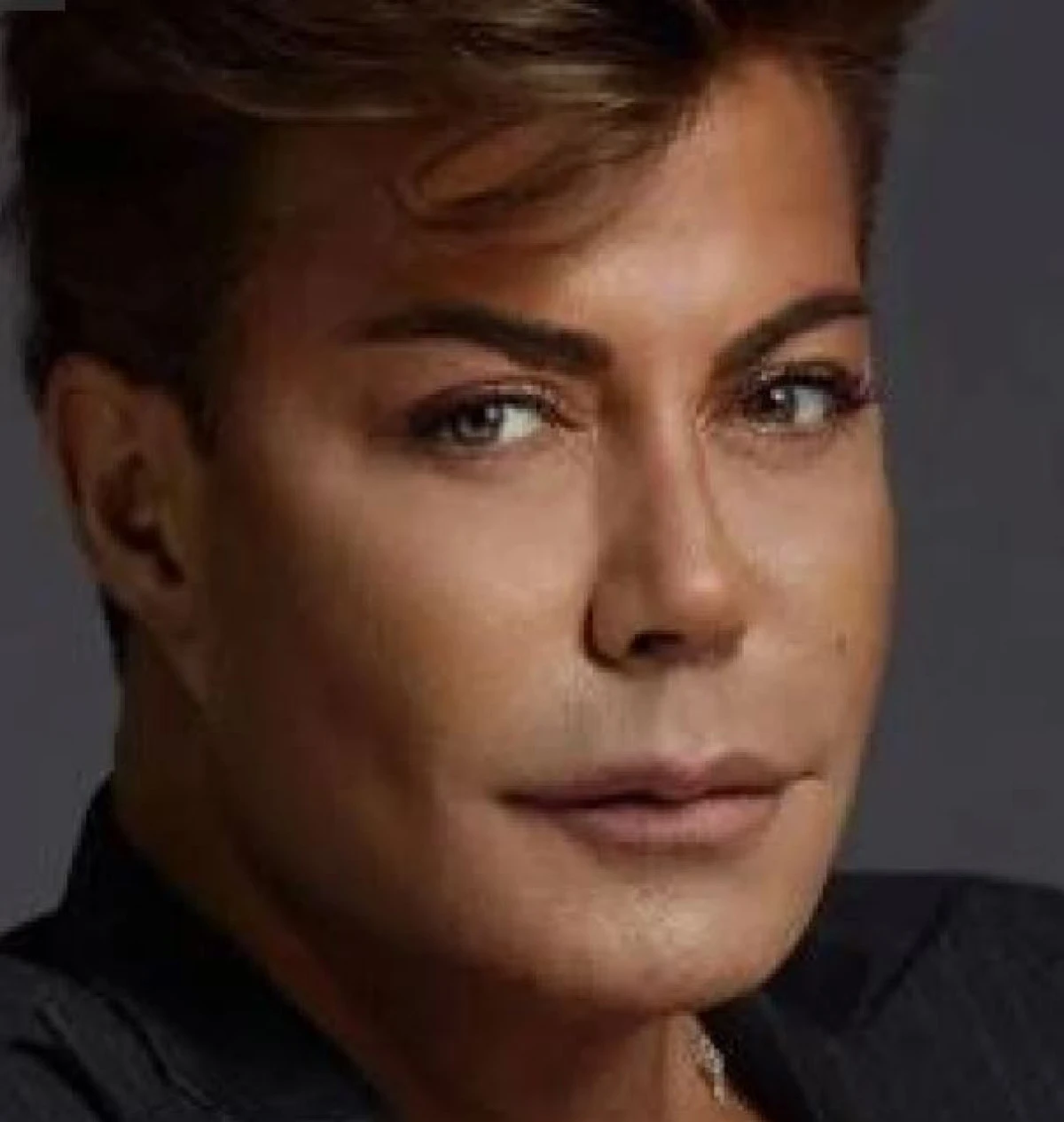 Fatih &Uuml;rek&rsquo;in Tedavisi Yoğun Bakımda S&uuml;r&uuml;yor